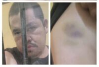 Diduga Jadi Korban Kriminalisasi, Tahanan Polres Pelalawan Alami Penyiksaan