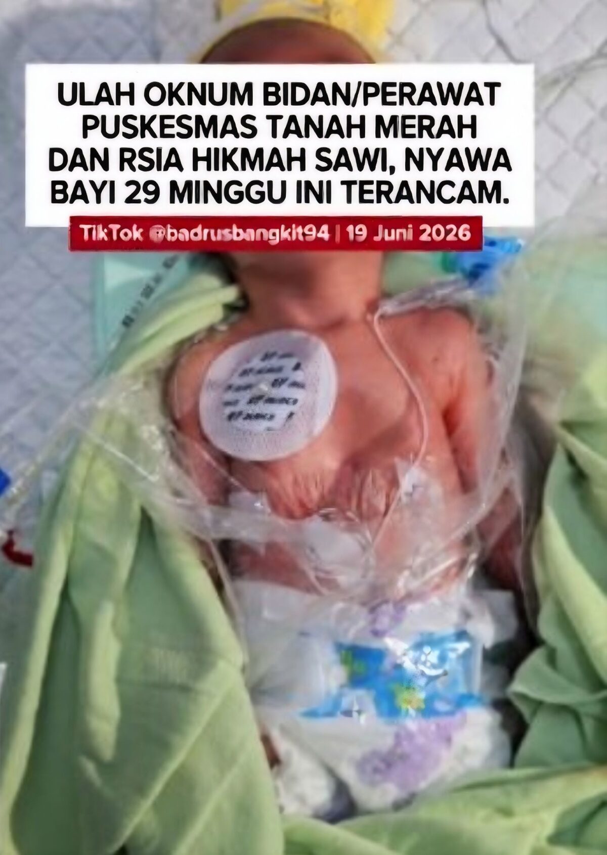 Segera! Kepala Dinas Kesehatan Bangkalan Klarifikasi Dugaan Polemik Bayi Prematur Asal Tanah Merah.